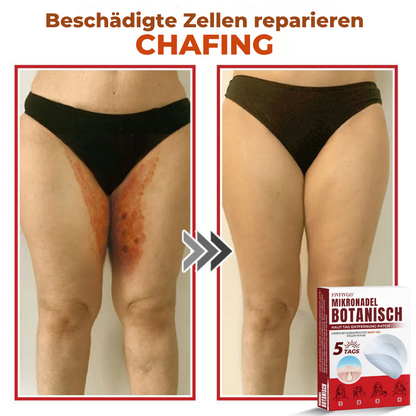 Fivfivgo® MikroNadel Botanisch Haut Tag Entfernung Patch 🇩🇪 Hergestellt in der Germany