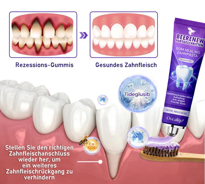 Oveallgo® BeeRenew Zahnpasta für fortgeschrittene Zahnfleischheilung