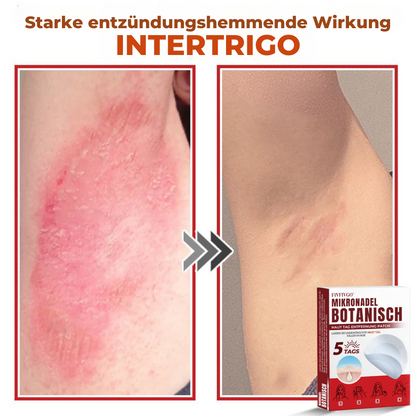 Fivfivgo® MikroNadel Botanisch Haut Tag Entfernung Patch 🇩🇪 Hergestellt in der Germany
