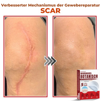 Fivfivgo® MikroNadel Botanisch Haut Tag Entfernung Patch 🇩🇪 Hergestellt in der Germany