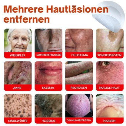 Fivfivgo® MikroNadel Botanisch Haut Tag Entfernung Patch 🇩🇪 Hergestellt in der Germany