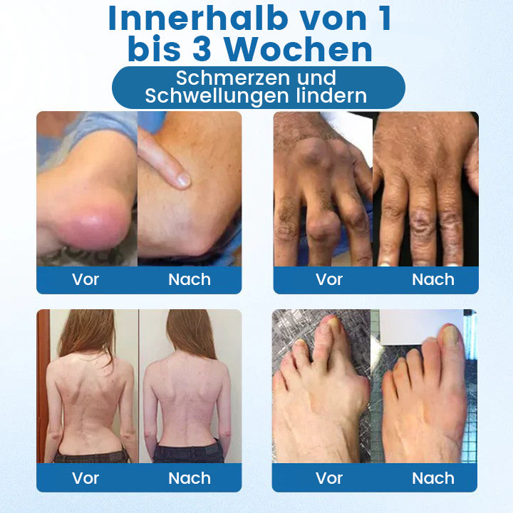 Oveallgo® BPC-157 Gelenk‑Repair‑Creme