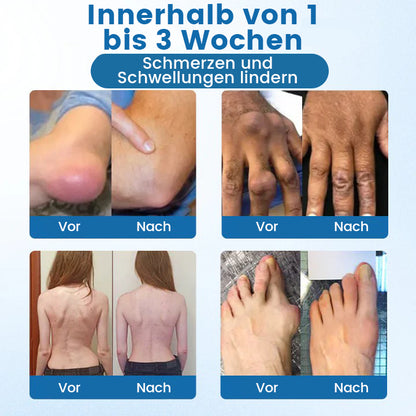 Oveallgo® BPC-157 Gelenk‑Repair‑Creme