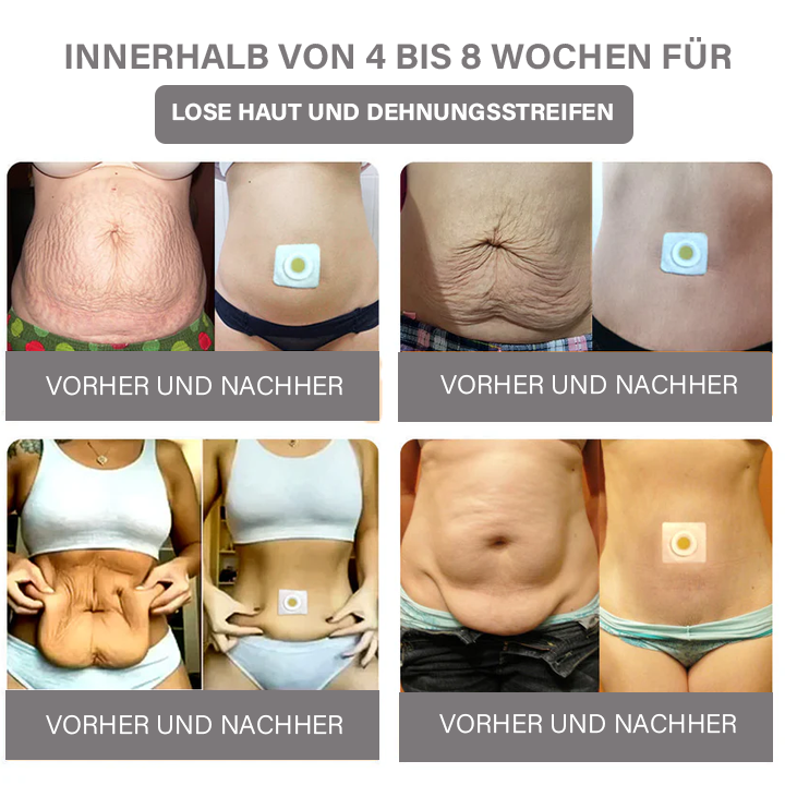 Oveallgo™ Schlangengift-Lymph-Detox-Pflaster (Für alle lymphatischen Probleme und Fettleibigkeit)