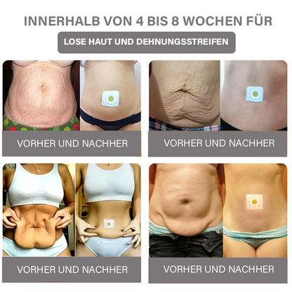 Oveallgo™ Schlangengift-Lymph-Detox-Pflaster (Für alle lymphatischen Probleme und Fettleibigkeit)