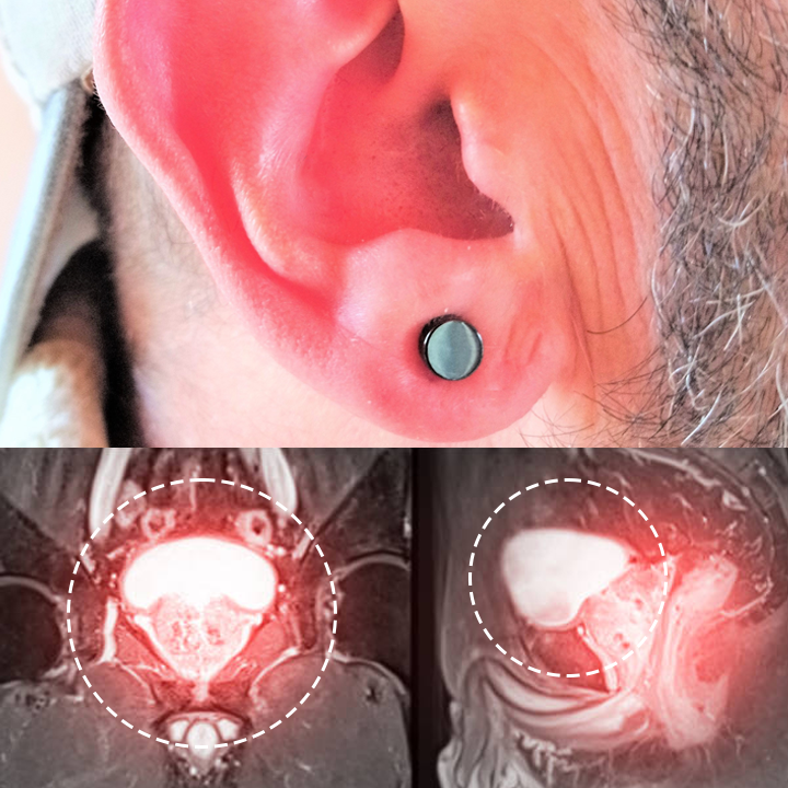 Oveallgo™ Magnetherapy Prostate Wellness Earring