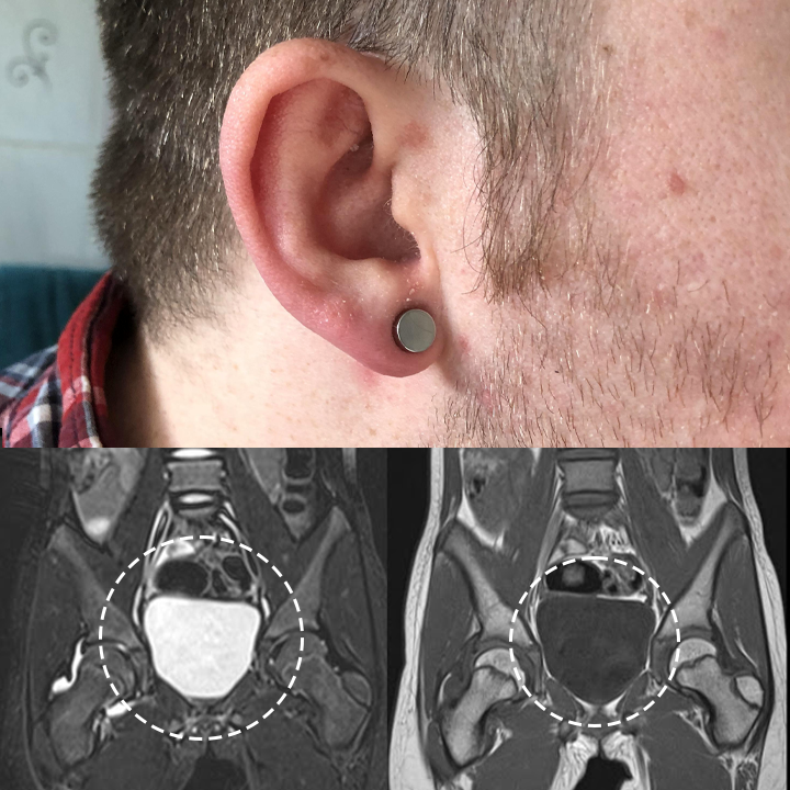 Oveallgo™ Magnetherapy Prostate Wellness Earring