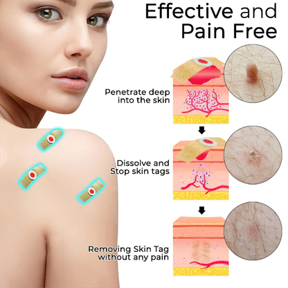 Fivfivgo® Skin Tags & Mole Nachsorge Schutzpflaster