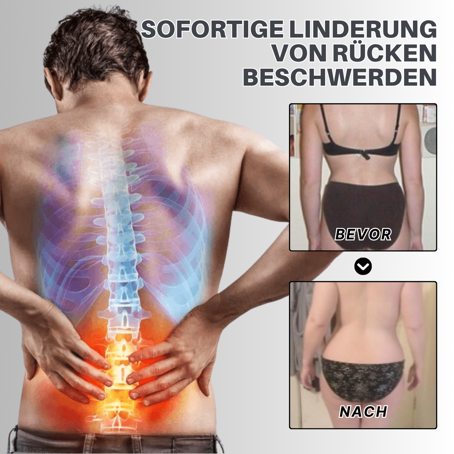 NovaRX® Ischias Erleichternd Creme