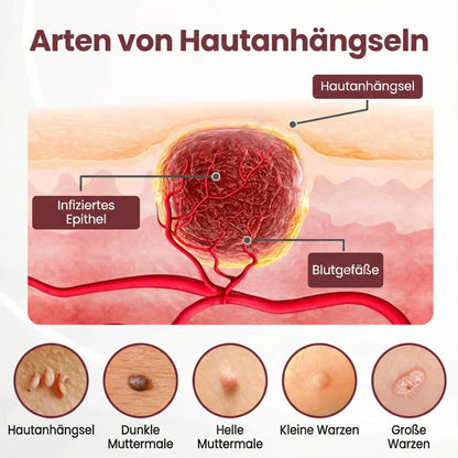 Oveallgo® KeraErase Dual-Action Erneuerungscreme