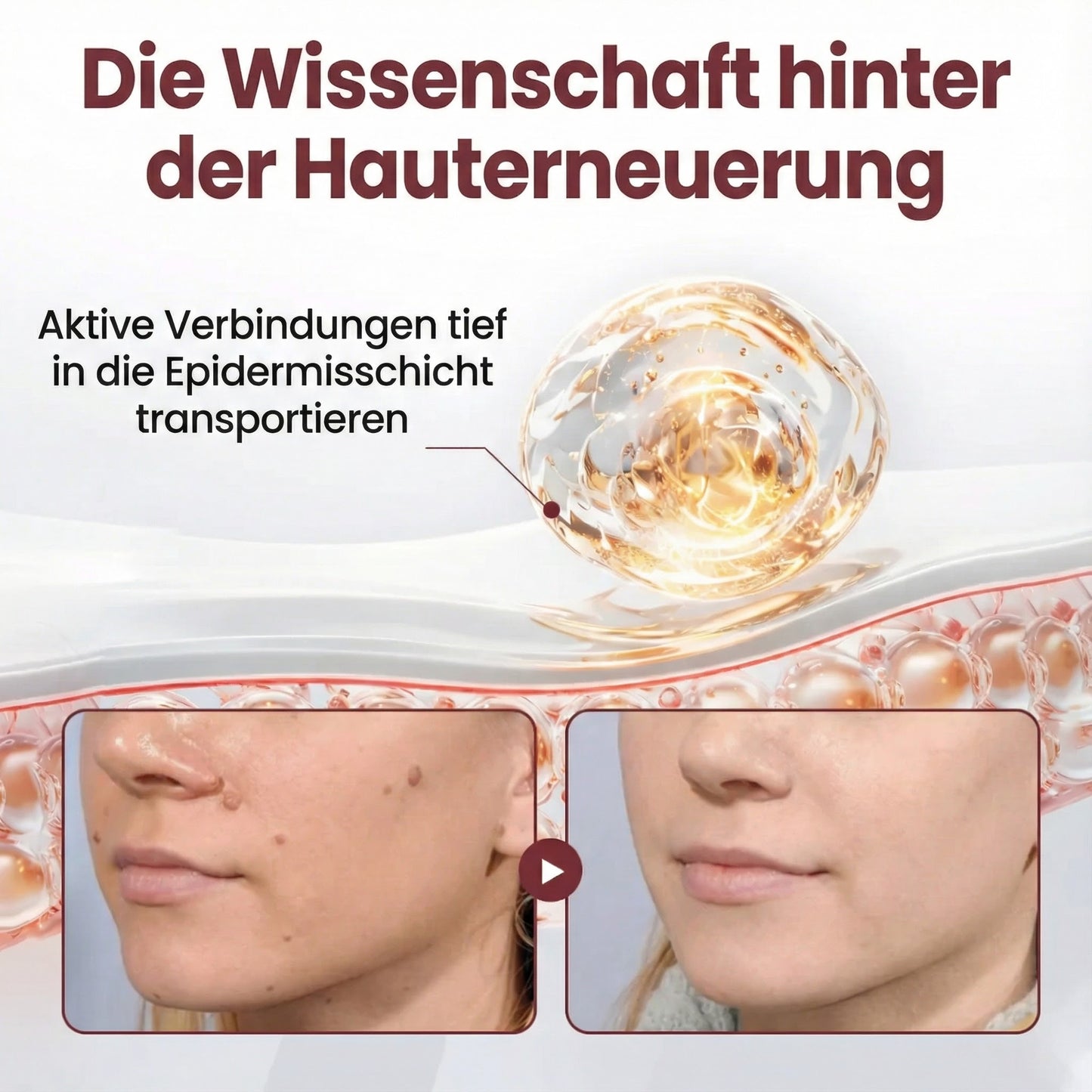 Oveallgo® KeraErase Dual-Action Erneuerungscreme