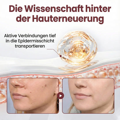 Oveallgo® KeraErase Dual-Action Erneuerungscreme