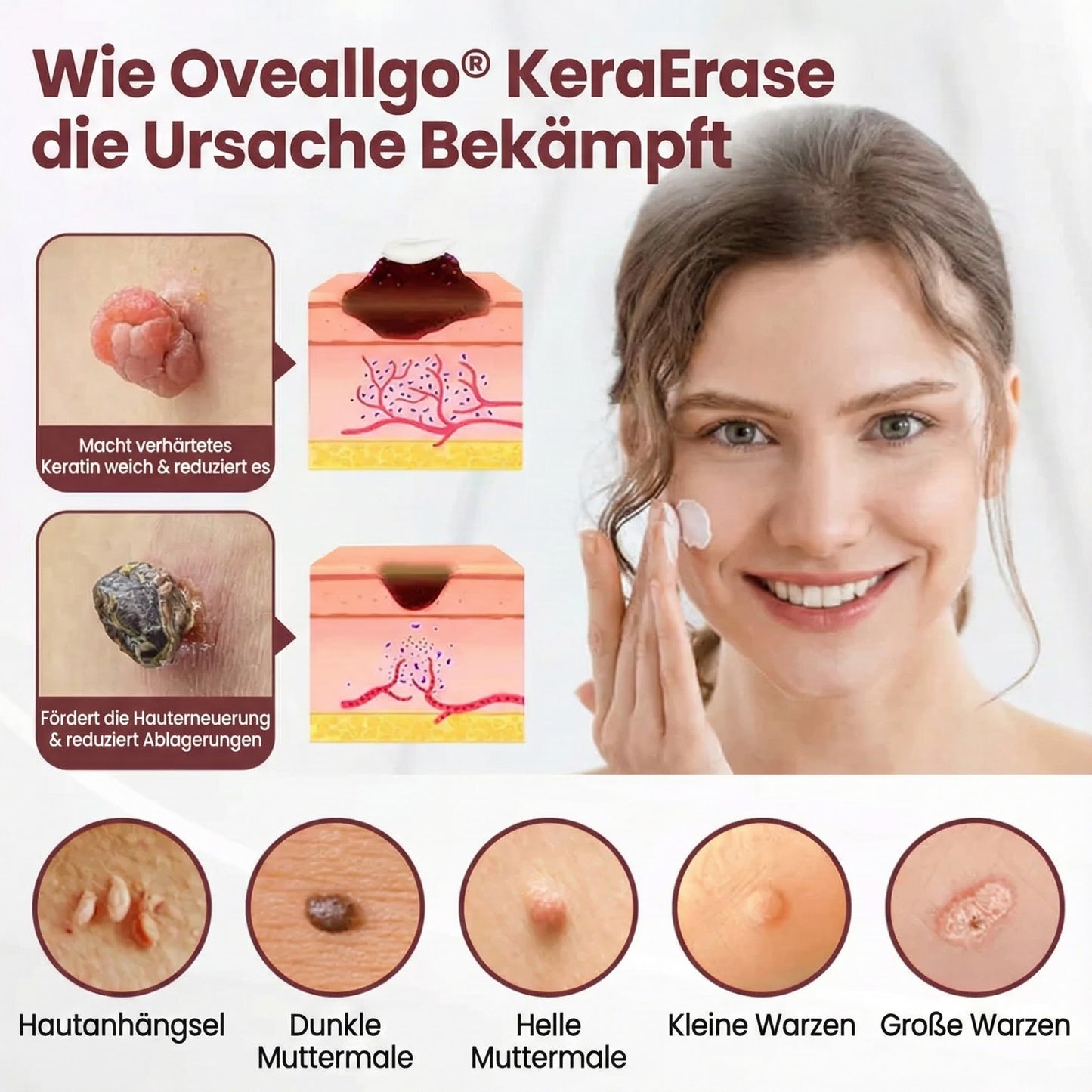 Oveallgo® KeraErase Dual-Action Erneuerungscreme