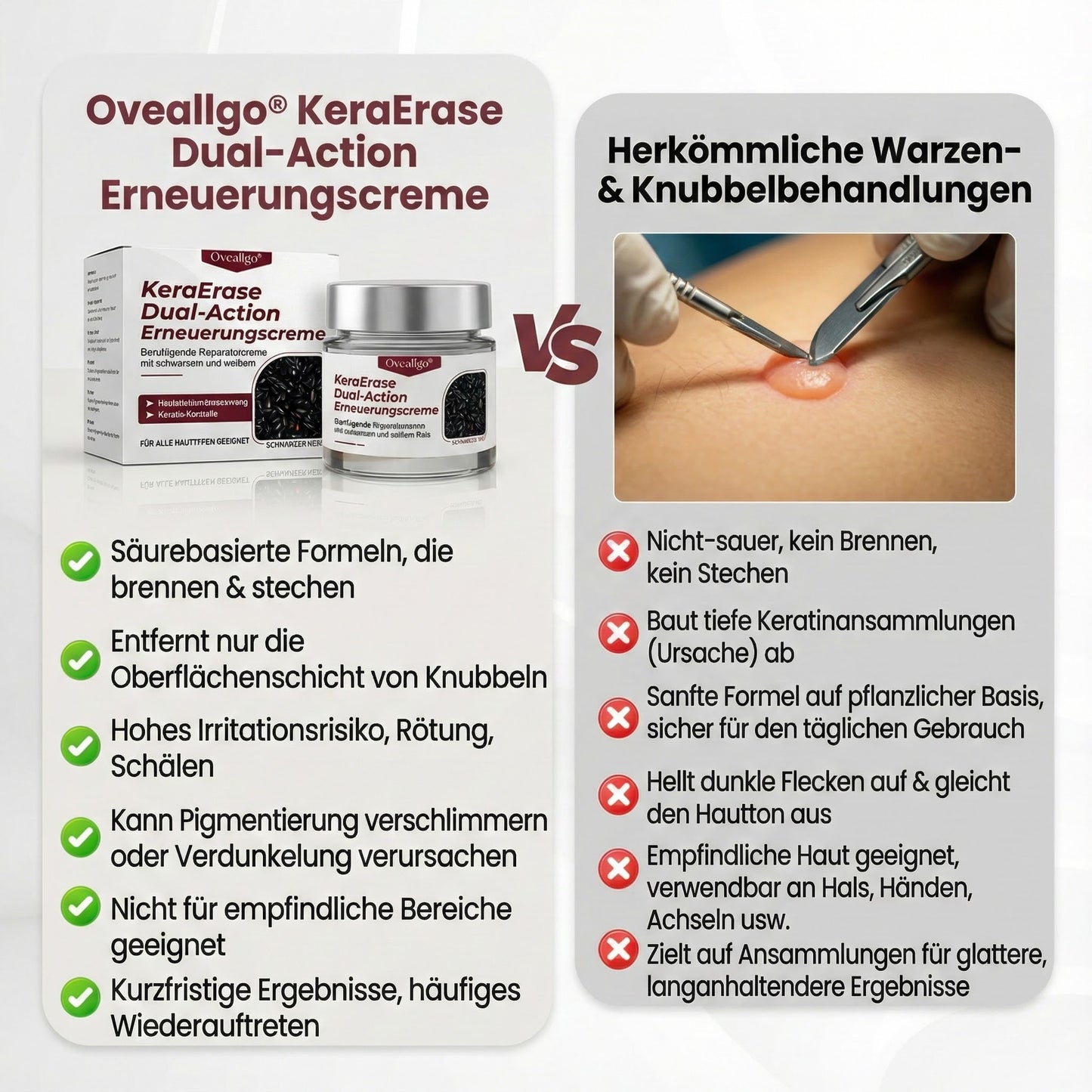 Oveallgo® KeraErase Dual-Action Erneuerungscreme