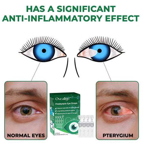 Oveallgo™ Presbyopia Eye Drops