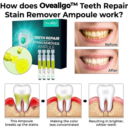 Oveallgo™ Teeth Repair Stain Remover Ampoule